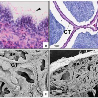 A Light Micrograph Of The Epididymis Showing The Epithelium And The