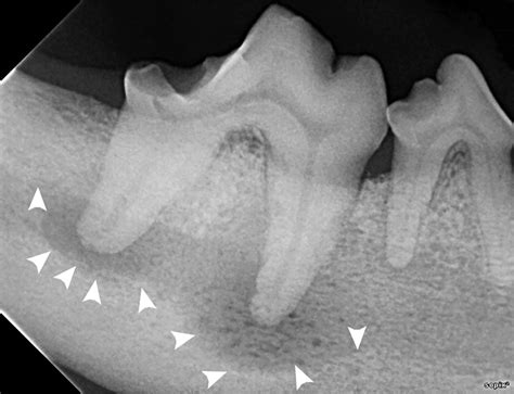 Interpreting Dental Radiographs | Clinician's Brief