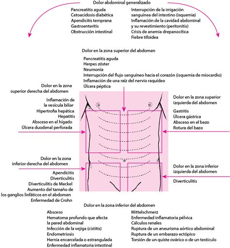 Imagecausas Del Dolor Abdominal Por Localización Manuale Merck Versión