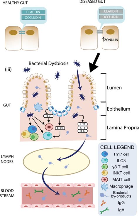 Altered intestinal microbiome in SpA and its structural and immune ... 
