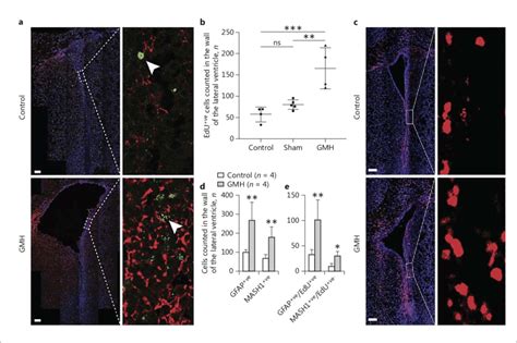 Germinal Matrix Haemorrhage Gmh Activates Proliferation In The Wall