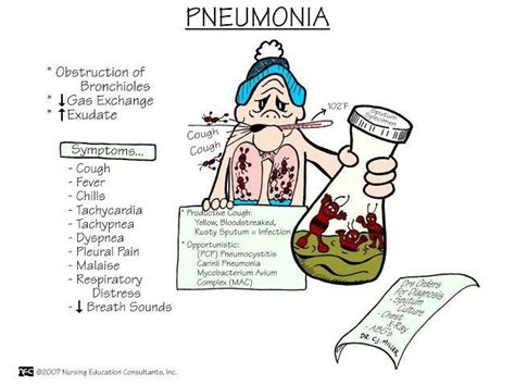 Pin By Милана Пузовић On Medical Nursing Mnemonics Medical Surgical