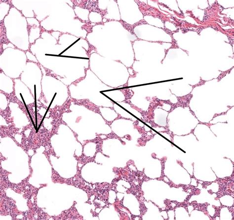 Lung Alveoli Histology Diagram Quizlet The Best Porn Website