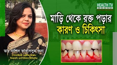 মাড়ি দিয়ে রক্ত পড়ার কারণ ও চিকিৎসা Gum Bleeding Dr Nashid