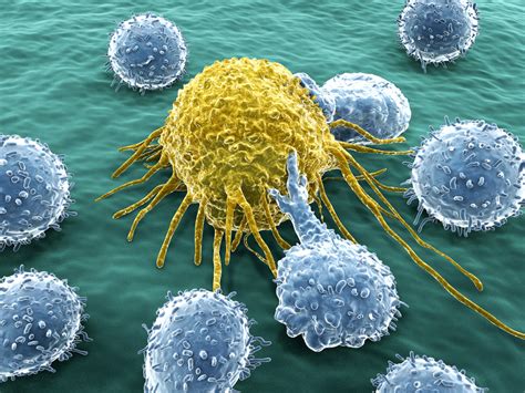 Immunotherapy Combo for Metastatic Melanoma Shows Early Promise