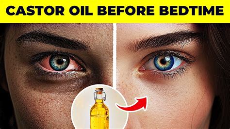 Use Castor Oil Before Going To Sleep And Watch What Happens Youtube