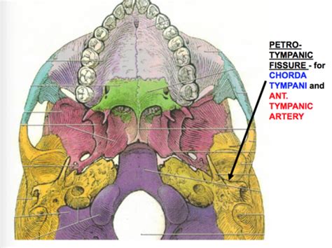 Chorda Tympani Petrotympanic Fissure