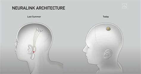 Elon Musk's Neuralink unveils sleek V0.9 device, uses sassy pigs for ...