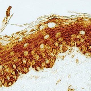 Succinate dehydrogenase reaction intensities in the esophagus ...