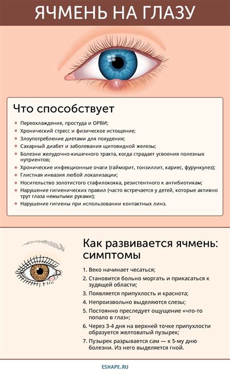 Ячмень на глазу, как лечить быстро дома народными средствами и ...