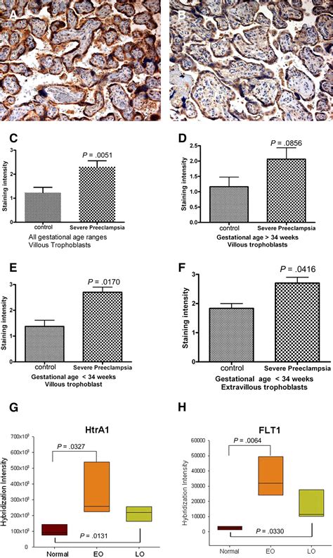 Elevated Expression Of Serine Protease Htra In Preeclampsia And Its