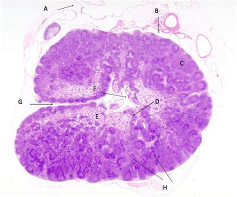 Identify A B C D E F G And H In This Section Of A Lymph Node