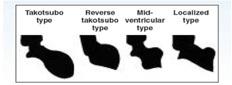 Figure From A Comprehensive Literature Review Of The Epidemiology