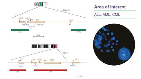 CytoCell BCR/ABL Translocation, Dual Fusion FISH Probe | OGT