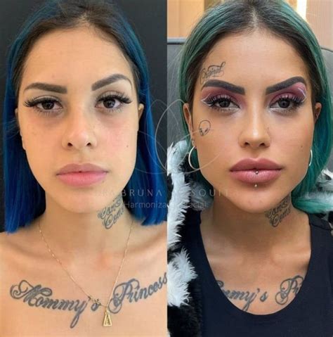 Tati Zaqui Antes E Depois Veja Fotos Da Cantora De Funk Antes Da Fama