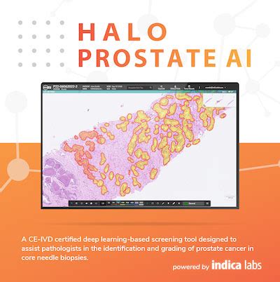 Halo Prostate Ai Indica Labs