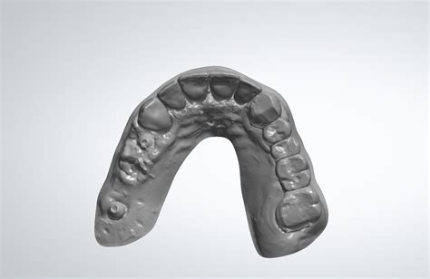 Fichier STL Couronnes et bridges de la mâchoire supérieure modèle en