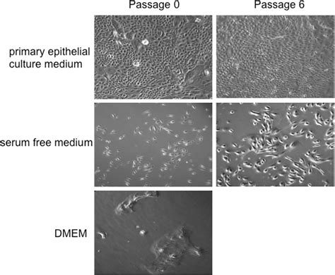 Morphology Of Human Normal Bronchial Epithelial Cells HNBEC In