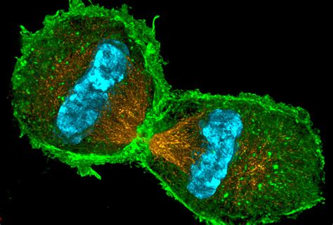 Introduction Multi Photon Microscopy