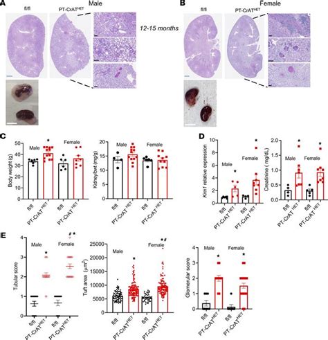 Jci Insight Intact Mitochondrial Substrate Efflux Is Essential For