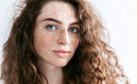 Treating freckles and pigmentation - Hope Dermatology