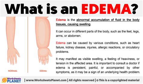 What Is An Edema Definition Of Edema