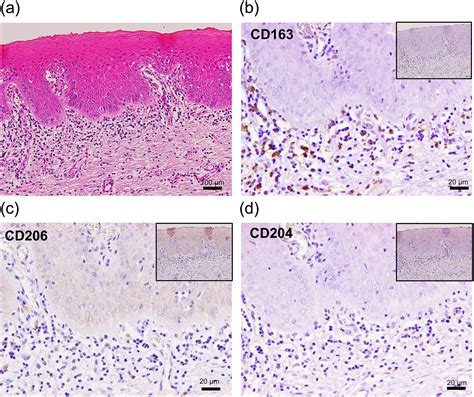 Macrophage Histology Em