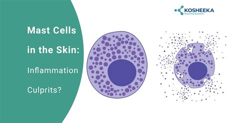 Mast Cells in the Skin: Inflammation Culprits? - Kosheeka