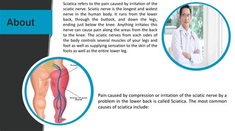 Ppt Sciatica Treatment In Kl Onespinemy Powerpoint Presentation