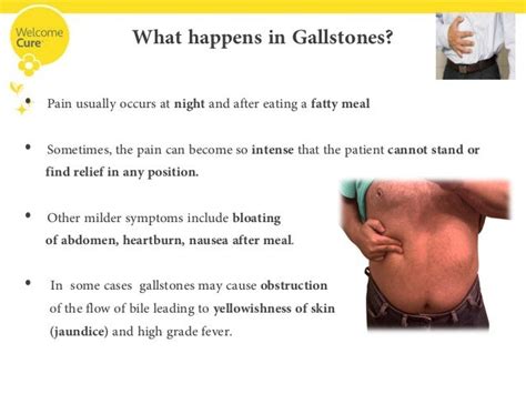 gallbladder pain symptoms images - usseek.com