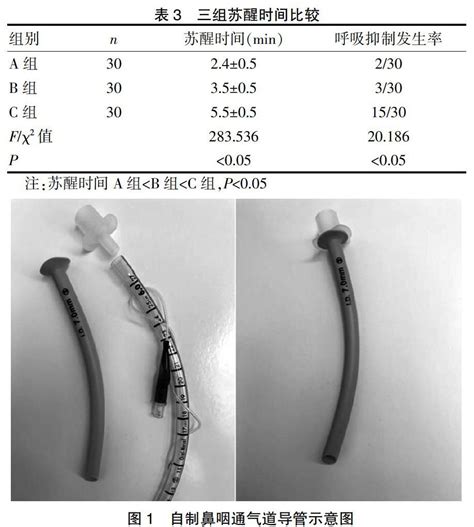 自制鼻咽通气道联合呼吸机在全凭静脉麻醉中的应用参考网