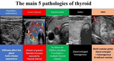 Labeled Thyroid Ultrasound