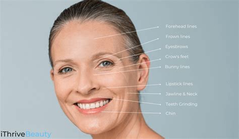 The Best Areas Of The Face For Cosmetic Botox Treatment Ithrivebeauty