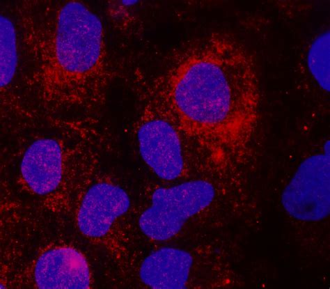 Inflammasome Antibody Panel Irap Ireal Biotechnology Inc