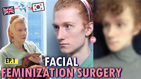 Sub Transgenders Facial And Body Feminization Surgery In Korea L Ffs