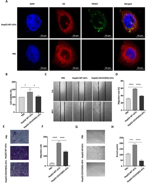 Hepg2 Derived Cd147 Sevs Promote Endothelial Cell Angiogenesis In Download Scientific Diagram