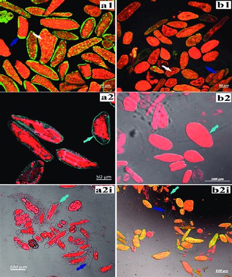 4 Confocal Laser Scanning Micrographs Of Intact Cells Of Cooked