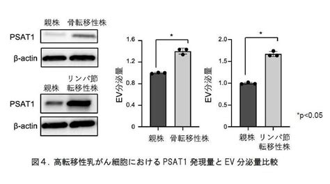 【東京医科大学】がん細胞をはじめとする種々のエクソソーム分泌の新たな機序解明 ～ 乳がんなどのがん転移阻害剤の開発に貢献する可能性