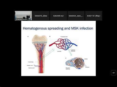 Lecture Infection Of Msk System Youtube