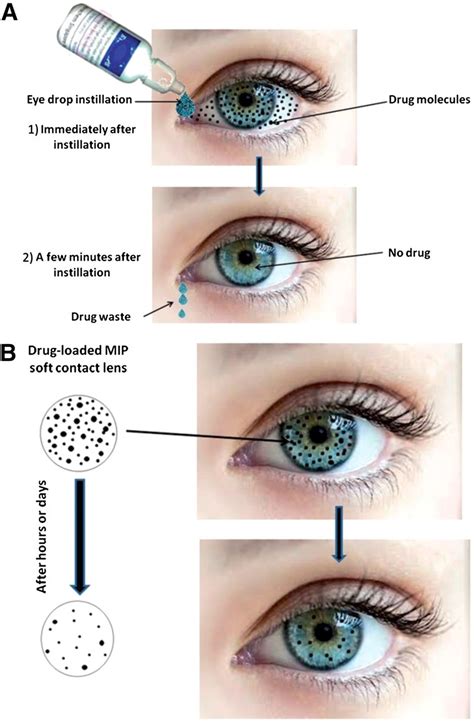 Ocular Drug Delivery Present Innovations And Future Challenges