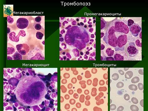 Диагностика заболеваний. Гематологический атлас - презентация онлайн