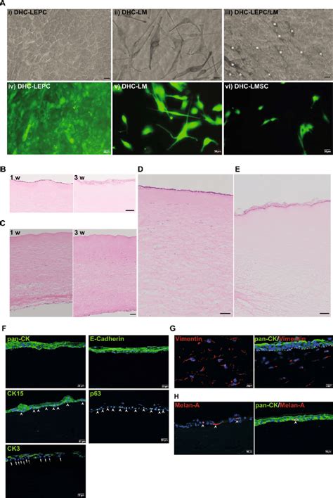 In Vitro Recellularization Of The Decellularized Human Cornea DHC A