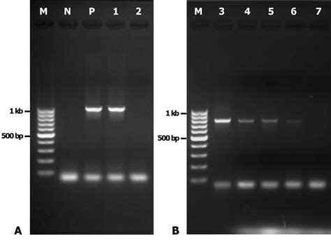 Gel Electrophoresis Of Amplicons From Fla Pcr Conditions A N Negative Download Scientific