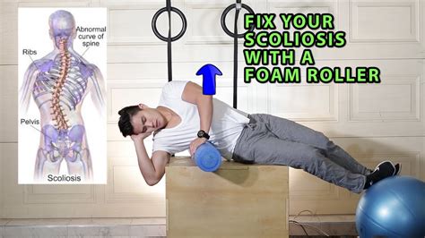 Fix Your Scoliosis With A Foam Roller Scroth S Method Youtube