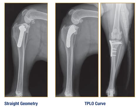 Tplo Plate Buy Store Eccosis Co