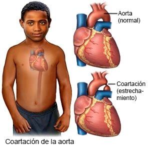 Fichas de aprendizaje HIPERTENSIÓN ARTERIAL Quizlet