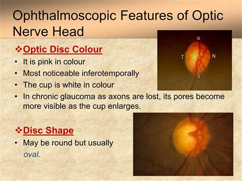 Anatomy and Physiology of Optic Nerve Dr.PrabhatDevkota.pptx