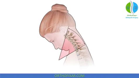 Cervical Spine Range Of Motion Orthofixar 2025