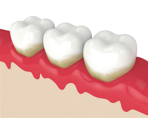 how to know if you have gum disease 11