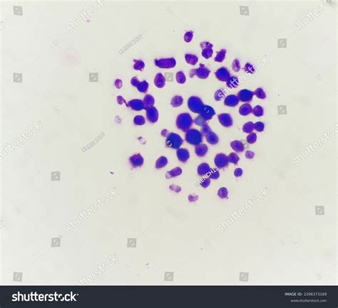 136 Opportunistic Fungal Pathogen Images, Stock Photos, 3D objects ... 